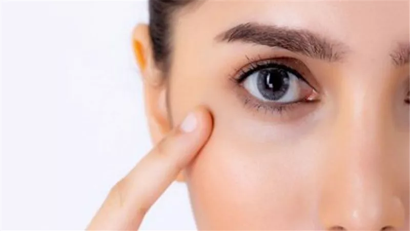 عادات خاطئة تؤدي للهالات السوداء حول العينين.. تعرف على طرق علاجها