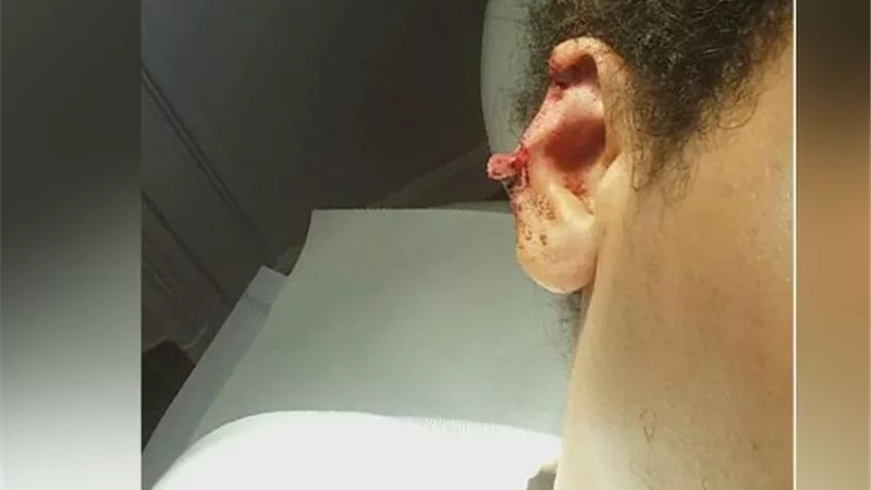 جزار يقطع أذن جاره بسبب خلافات الجيرة فى الدقهلية