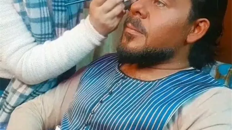 منذر ريحانة يغير لون جسده .. لهذا السبب