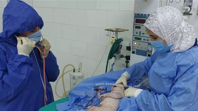 نجاح ولادة قيصرية لمريضة بـ فيروس كورونا بالشرقية