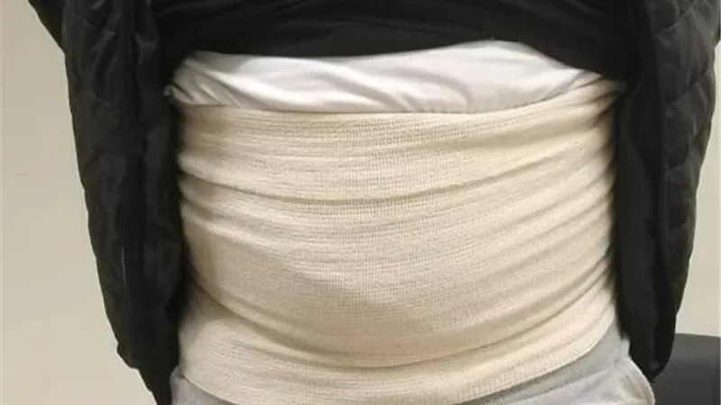 ضبط راكب يحاول تهريب 160 سماعة إذن تعويضية حول جسده بالمطار
