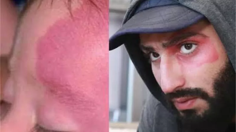 محمد الشرنوبى يكشف سر الوحمة الدموية فى 