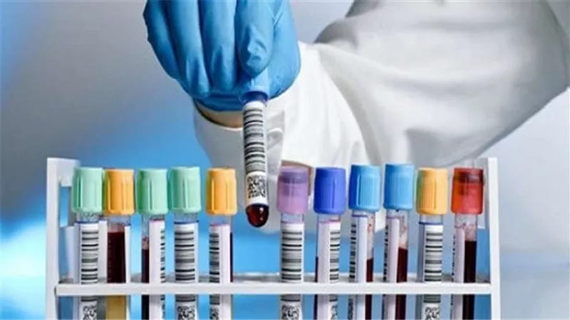حكم حصول الأطباء نسبة مقابل ارسال المرضي لعمل تحليل بمعمل معين؟ .. دار الإفتاء تجيب