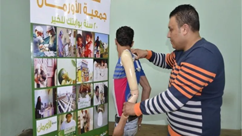 150 جهاز تعويضي هدية الأورمان للمرضى غير القادرين بقنا