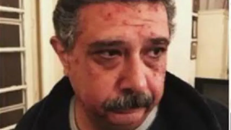 حقيقة اصابة ماجد الكدوانى بطفح جلدى