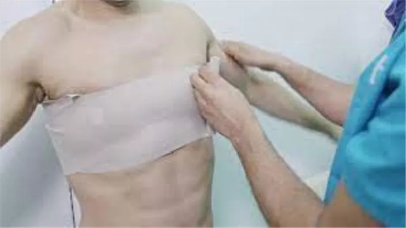 بالفيديو.. استشاري يكشف سبب التثدي لدى الرجال