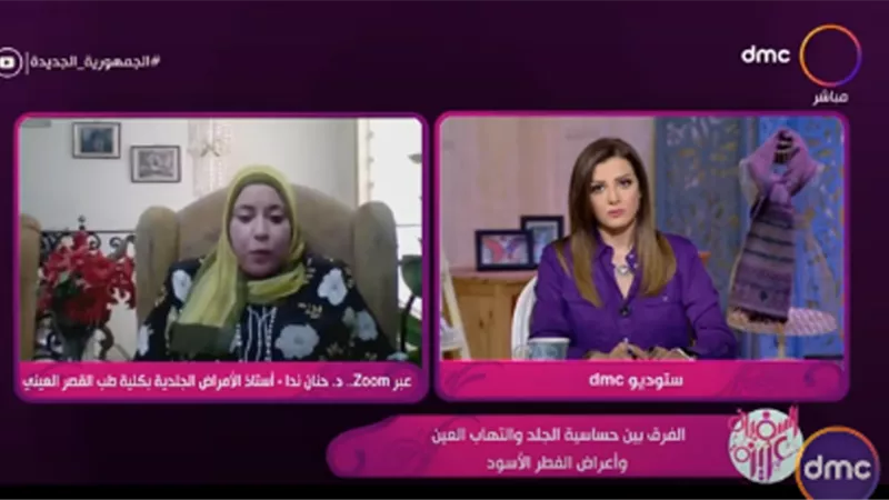 أستاذ جلدية بالقصر العيني تكشف الأماكن التي يعيش فيها «الفطر الأسود» والأماكن التى يدخل بها للجسم.. فيديو