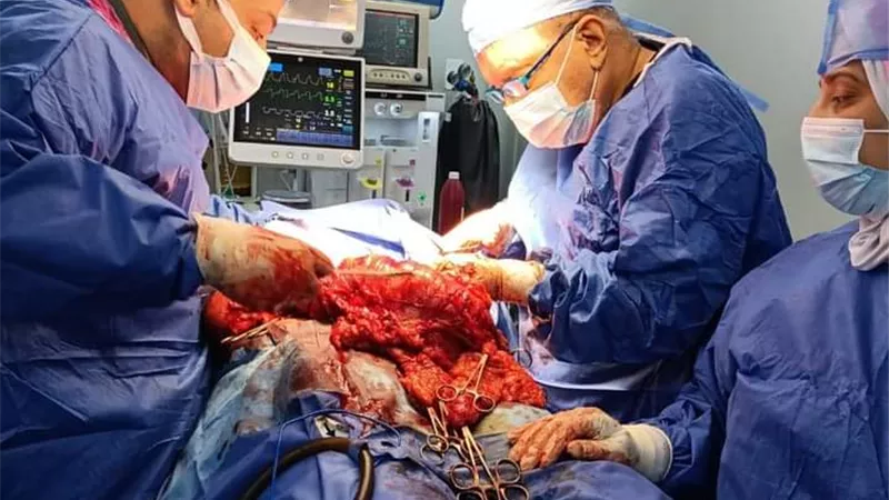 اطباء مستشفى مطروح العام الكبرى ينجحون في اجراء عملية جراحية ذات مهارة خاصة