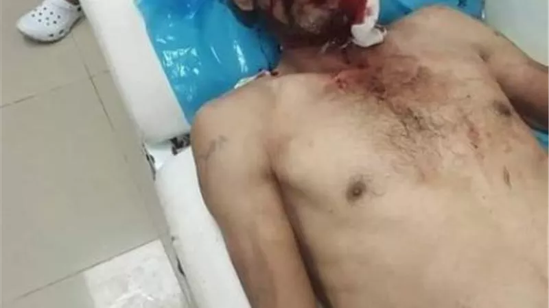 3 أشقاء في سرابيوم بالإسماعيلية مزقوا جسد زوج والدتهم بالأسلحة البيضاء..صور