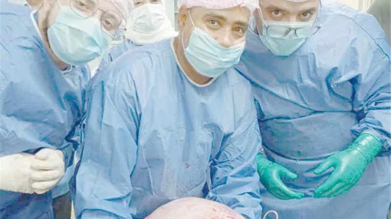 استئصال ورم 15 كجم من فتاة بمستشفي سوهاج