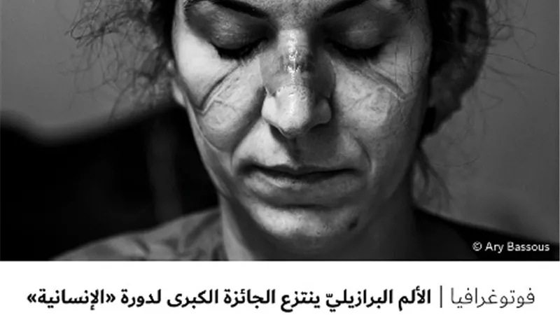 الألم البرازيليّ ينتزع الجائزة الكبرى لدورة 
