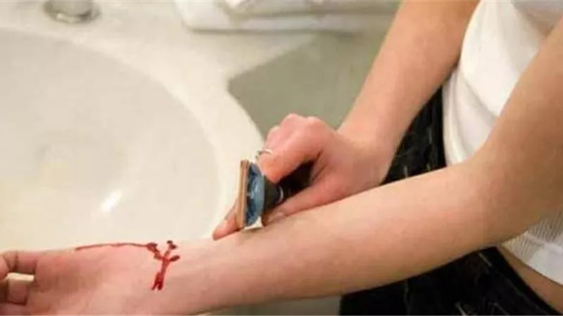 قطعت يدها طمعاً فى أموال التأمينات.. فسجنت 5 سنوات بتهمة الاحتيال