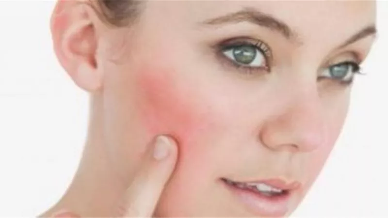 طرق طبيعية للقضاء على 
