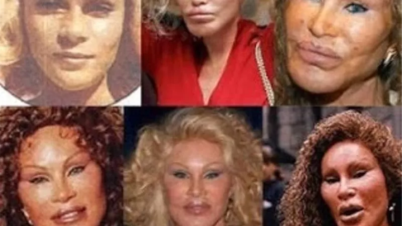 10 مشاهير شوهتهم عمليات التجميل بعد انفاق الاف الدولارات