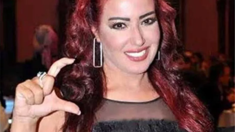 أول رد من سمية الخشاب على صورتها المثيرة للجدل بعد زواج أحمد سعد
