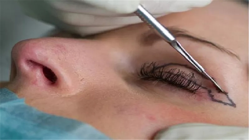 ما حكم عمليات التجميل وخاصة اذا كانت فى شئ يسبب لى ضيق نفسى ؟ .. دار الإفتاء تجيب