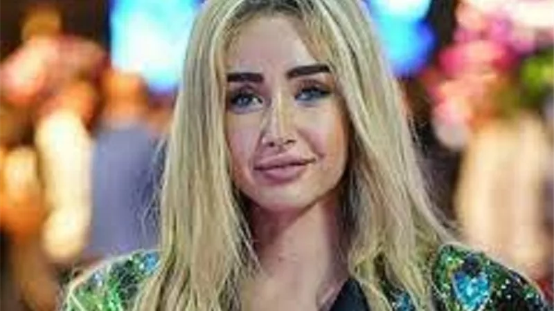 أول تعليق من فرح الزاهد بعد تعرضها لحادث سير