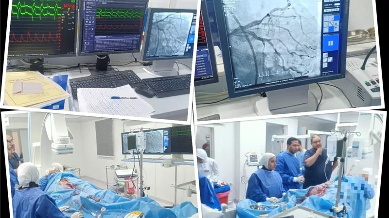إنقاذ مريض بعد توقف عضلة القلب بمستشفى السويس العام