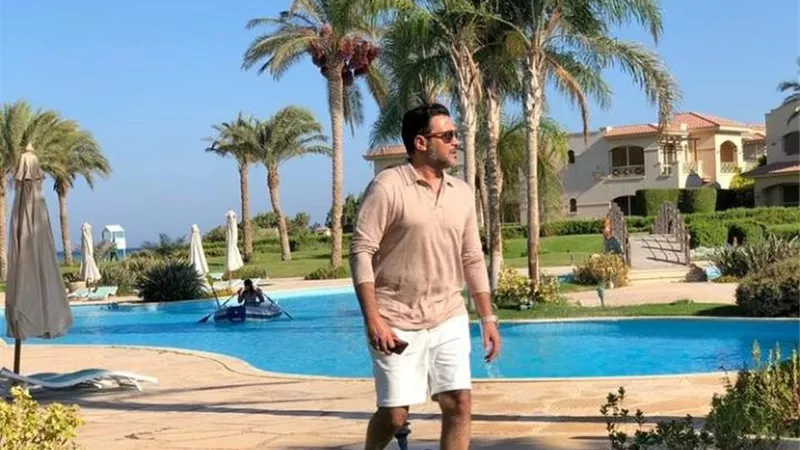 محمد رجب يخطف الأنظار بإطلالة صيفية