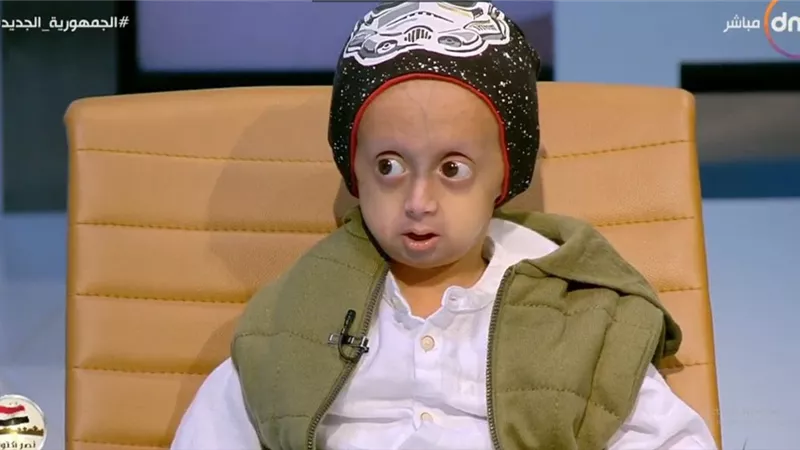 شاهد.. قصة أول يوم دراسة للطفل زين المصاب بالشيخوخة المبكرة