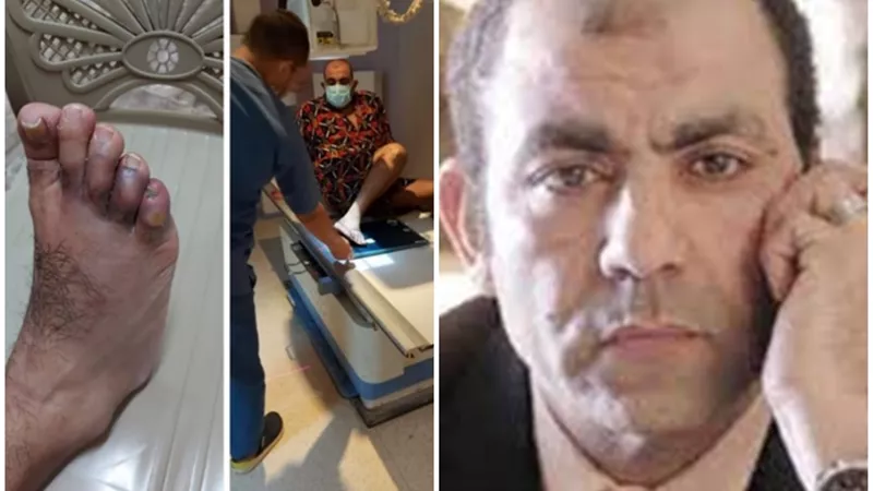 الألم فظيع.. إصابة محسن منصور وسامح عبد العزيز فى لوكيشن تصوير 