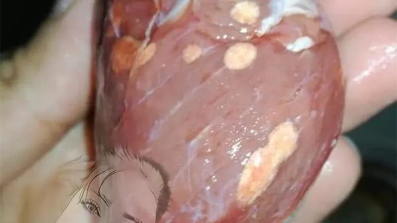 احذر .. حروق التجميد ونمو العفن او الفطريات في الفريزر