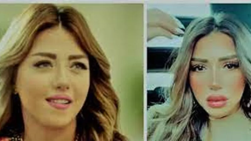 سارة سلامة تكشف حقيقة خضوعها لعملية تجميل