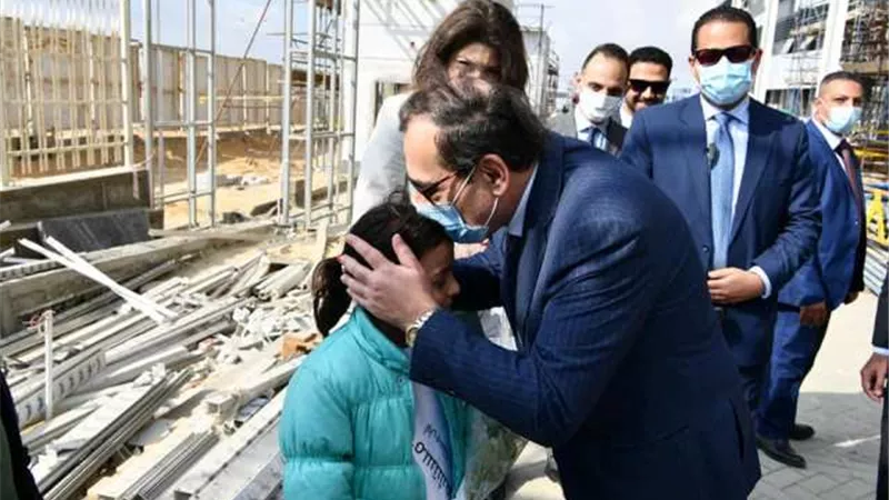 وزير البترول يزور مستشفى أهل مصر لعلاج مصابى الحروق بالمجان