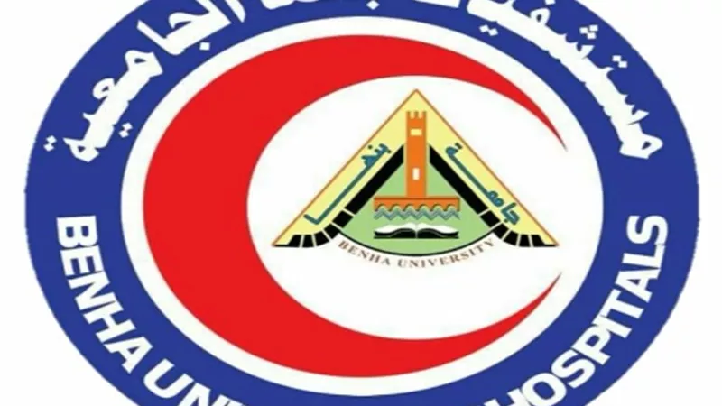مستشفيات جامعة بنها تواصل التطعيم ضد شلل الاطفال