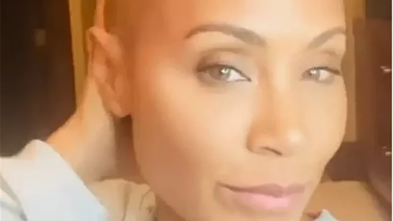على غرار شيرين عبد الوهاب.. زوجة ويل سميث حليقة الشعر بسبب الثعلبة.. فيديو