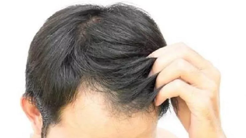 صبغ الشعر باللون الأسود..ما حكمه؟