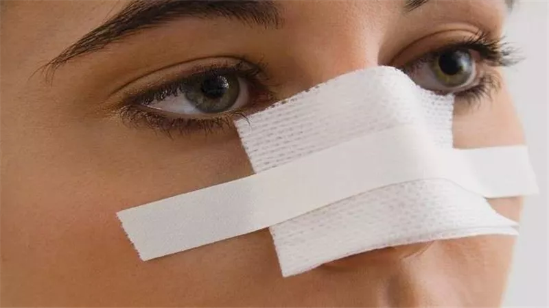 تقنية جديدة لتجميل الأنف بدون جراحة فى دقائق