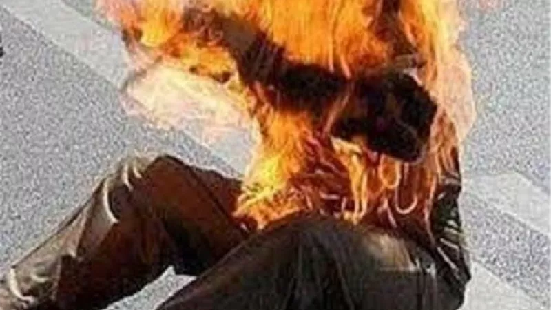 بسبب مروره بأزمة نفسية.. مواطن يضرم النيران فى نفسه بالغربية
