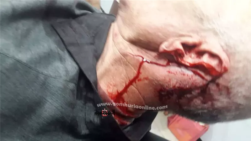 يقطعوا أذن وإصبع جارهم ونجله للخلافات علي قطعة أرض بالدقهلية