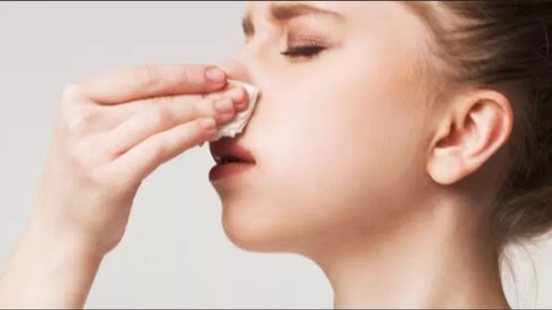 هذه هي أسباب نزيف الأنف في فصل الشتاء