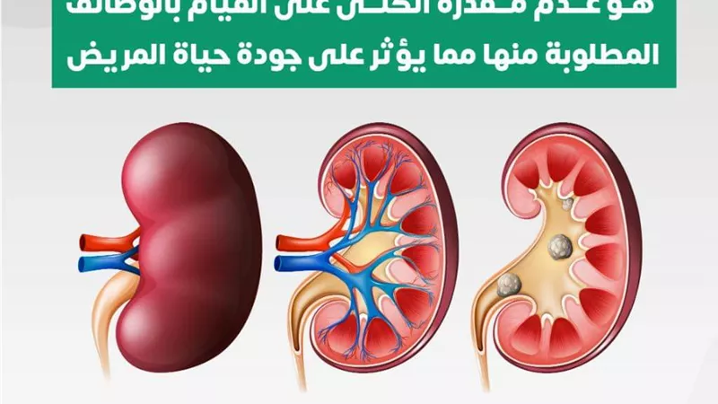بالفيديو .. خطوات التسجيل للكشف عن الاعتلال الكلوي
