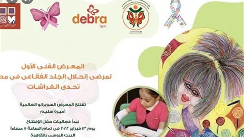 معرض تحدي الفراشات بالبيت الروسى الأحد المقبل