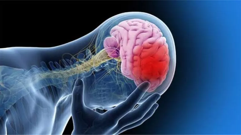 انتبه.. مشروب يسبب السكتة الدماغية بـ 5 أضعاف