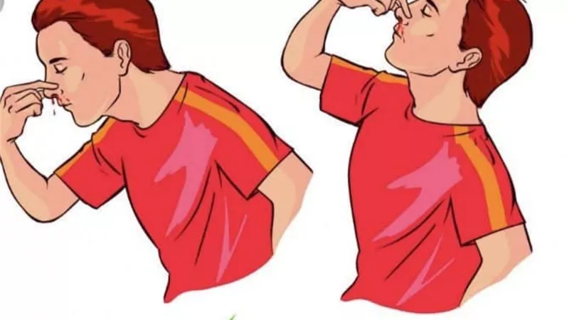 الإسعافات الأولية في حالة الإصابة بنزيف الأنف .. الصحة تكشف