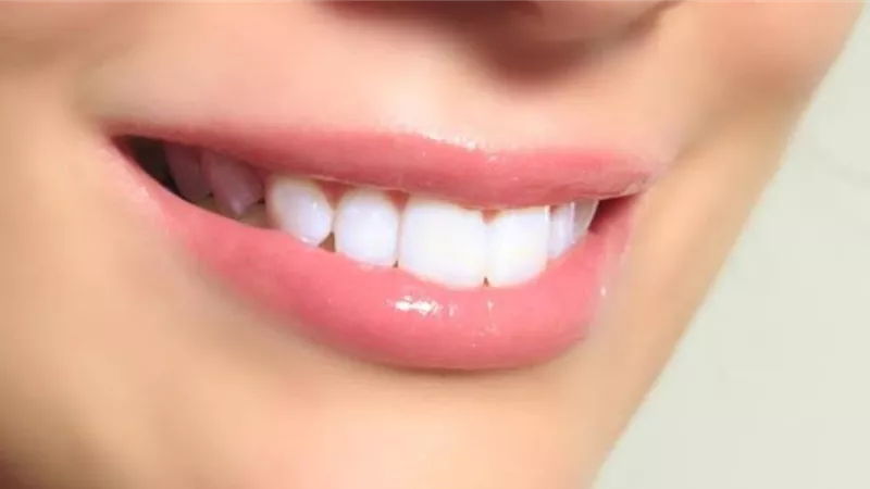 منها المشروبات الملونة.. أسباب اصفرار الأسنان .. الصحة تكشف