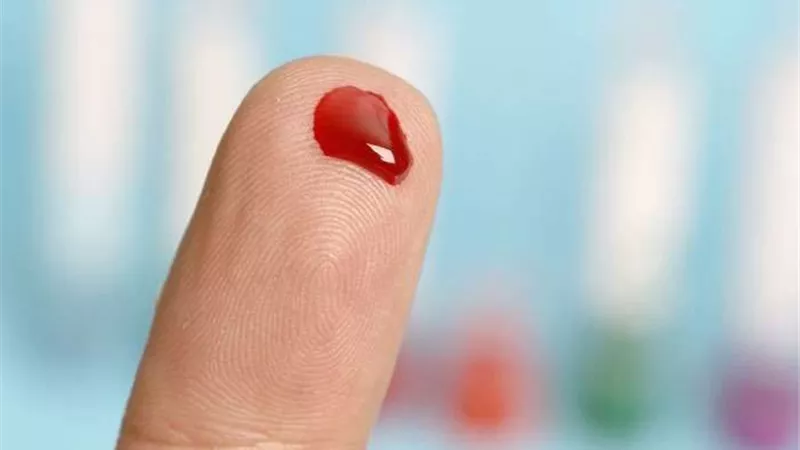 دم الإنسان..طاهر أم نجس؟