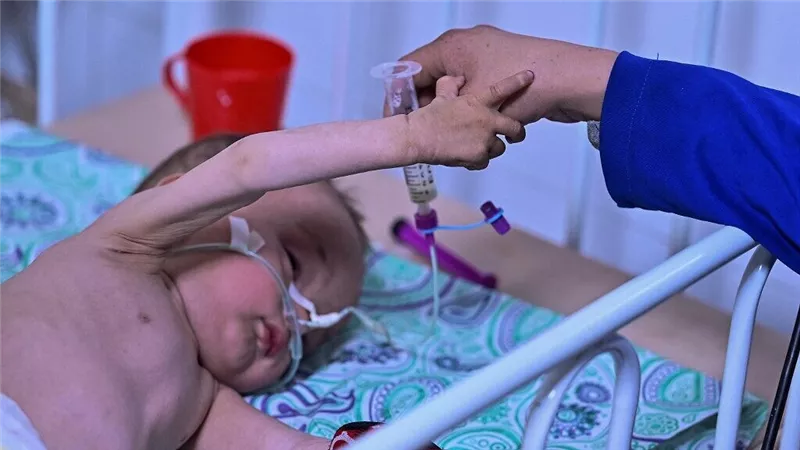 أفغانستان: وفاة 323 طفلا بسبب سوء التغذية منذ بداية العام