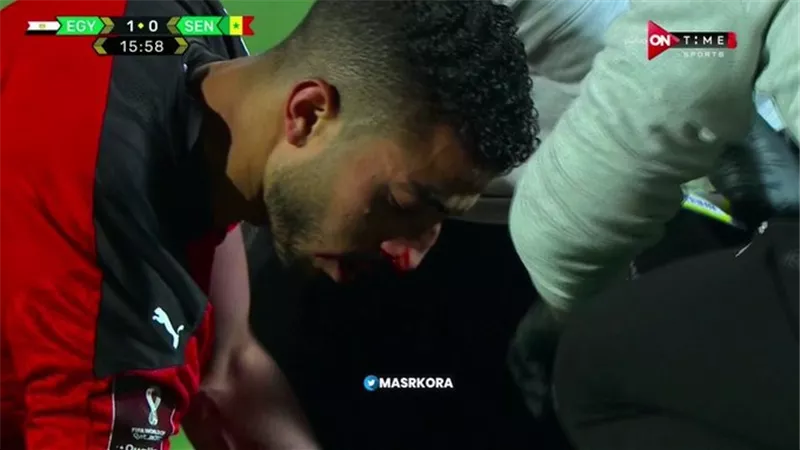 مصر والسنغال .. كيروش : عبد المنعم اصيب بكسر فى الانف