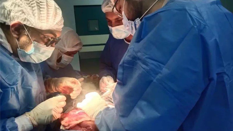أنقاذ شاب من تسمم الأمعاء وانفجار الزائده بمستشفى ناصر العام