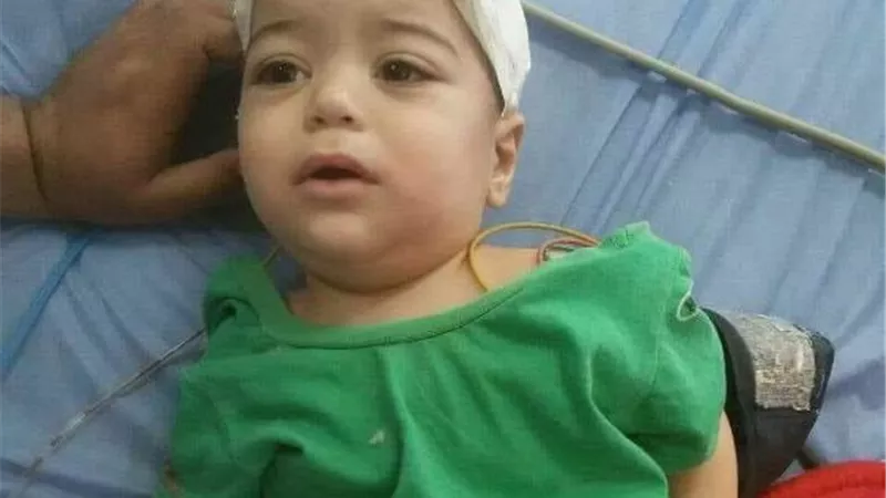 إنقاذ رضيع من الموت بعد تناوله صابون سائل فى الشرقية