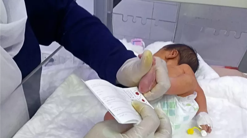 فحص ١٠ آلاف و466 طفل للكشف عن الأمراض الوراثية للأطفال المبتسرين بالشرقية