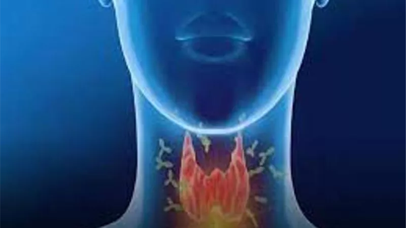 ما هو خمول الغدة الدرقية؟ هيئة الدواء تجيب