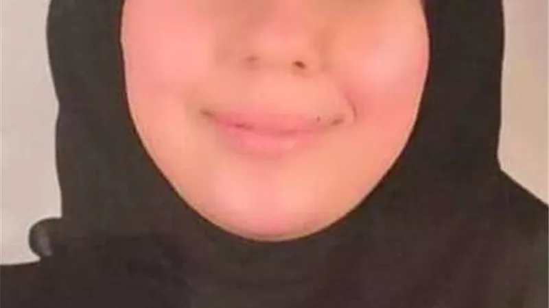 نزيف الانف 