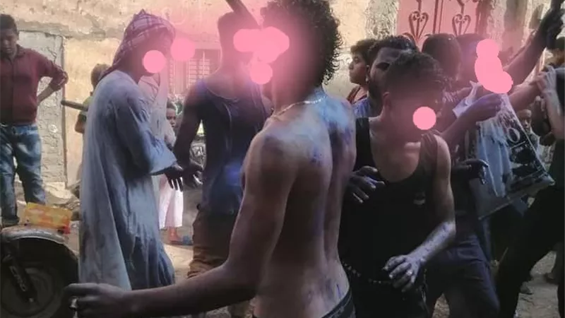 إصابة شقيقين في مشاجرة بقنا لخلافهم على قطعة أرض
