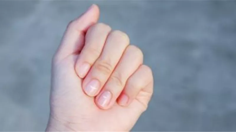صحتك من أظافرك ..نصائح تهمك